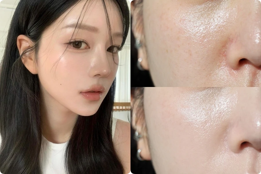 Muốn hạn chế tình trạng da đổ dầu và kiểm soát bã nhờn hiệu quả, chị em rất nên lưu ý 4 điều quan trọng này